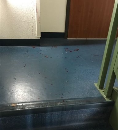 Blood located near entrance to apartment unit(s)